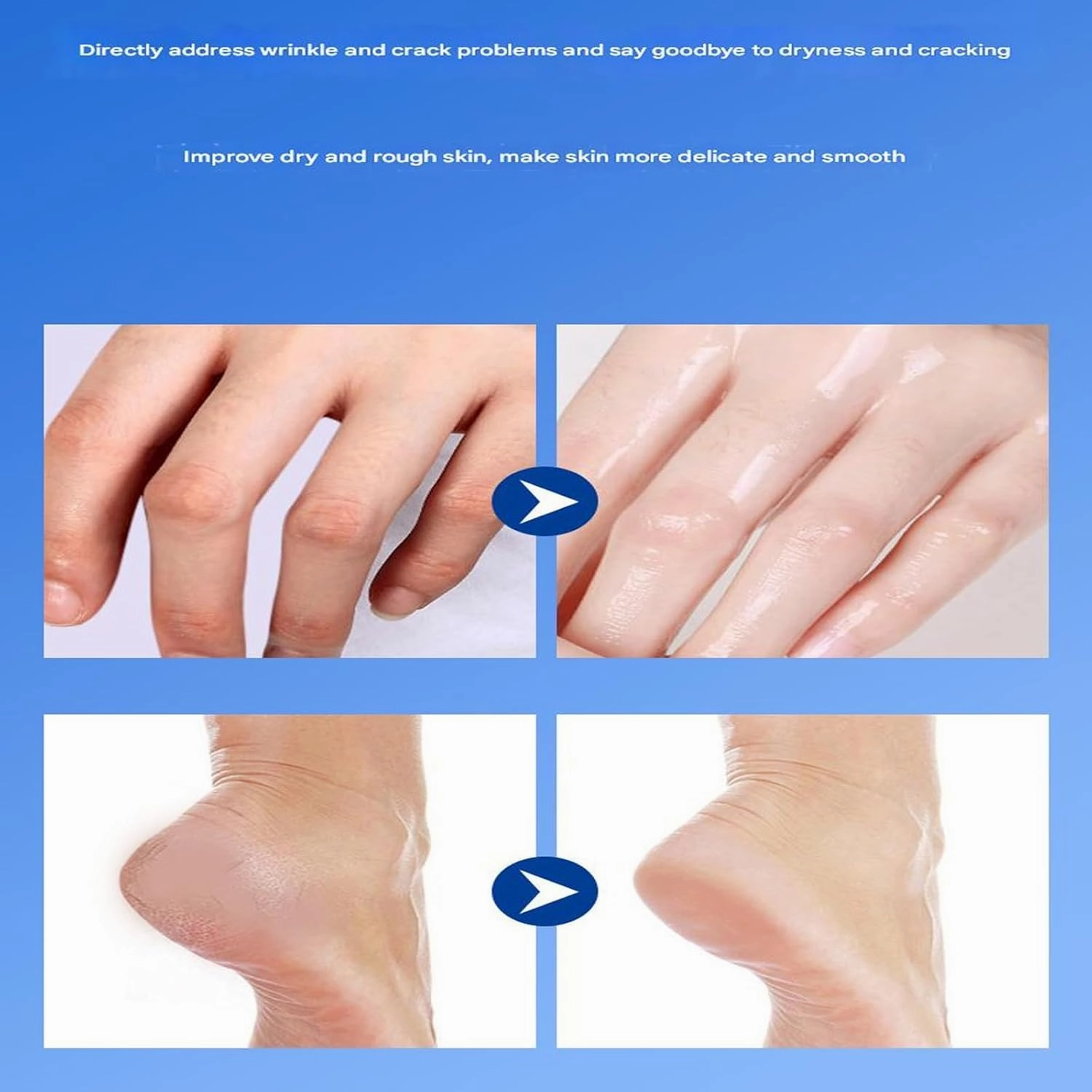 Equrhsa Foot Care Cream Cracked Feet,Eourhsa Crack Feet Prevention Stick,Cracked Heel Stick Balm,Heel Balm For Dry Crack FeetS,Anticrack Foot Cream Roll On,Hydrating And Anti-Cracking,Smoothing (A, 2)