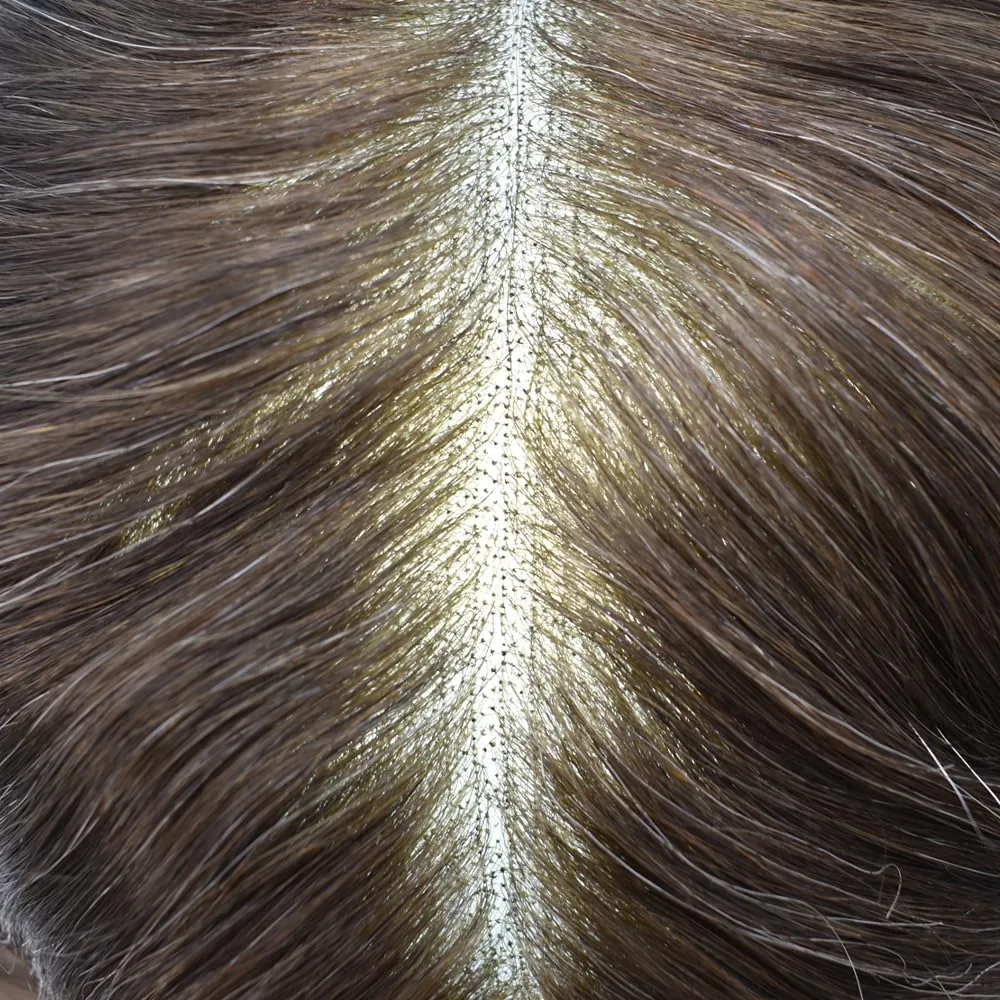Mens Toupee Hair Piece French Lace Toupee For Men Hair Replacement System For Men Hairpiece Natural Hairline 7X9#2 Darkest Brown