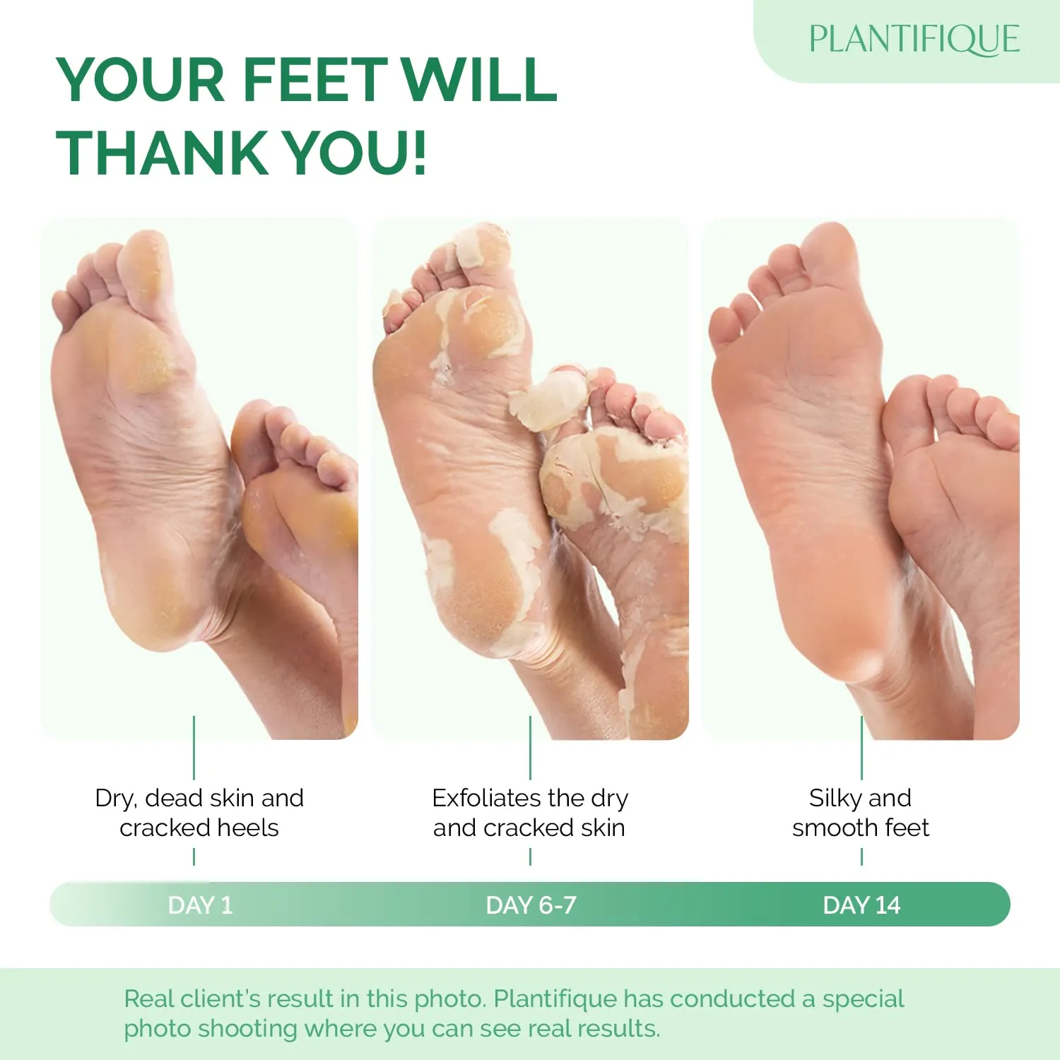 PLANTIFIQUE Foot Peeling Mask - Dermatologically Tested to Repair Heels & Remove Dead Skin for Baby Soft Feet - Exfoliating Peel Mask for Cracked Feet (Peach, 2 pack)